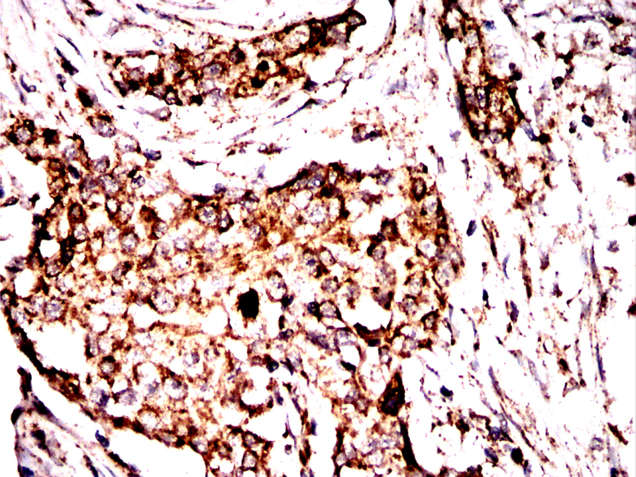 IHC